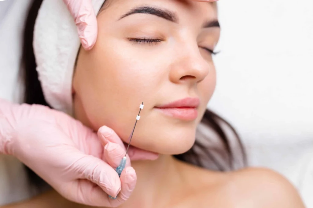 PDO Thread Lift in Draper, UT | Magnifique Med Spa