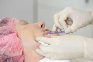 PDO Thread Lift in Draper, UT by Magnifique Med Spa