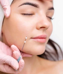 PDO Thread Lift in Draper, UT | Magnifique Med Spa